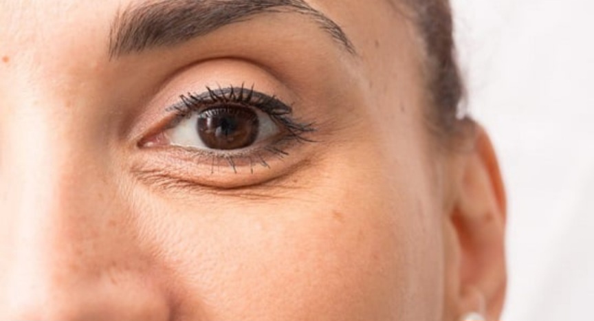  خطوات بسيطة للحصول على بشرة أكثر نضارة حول العين